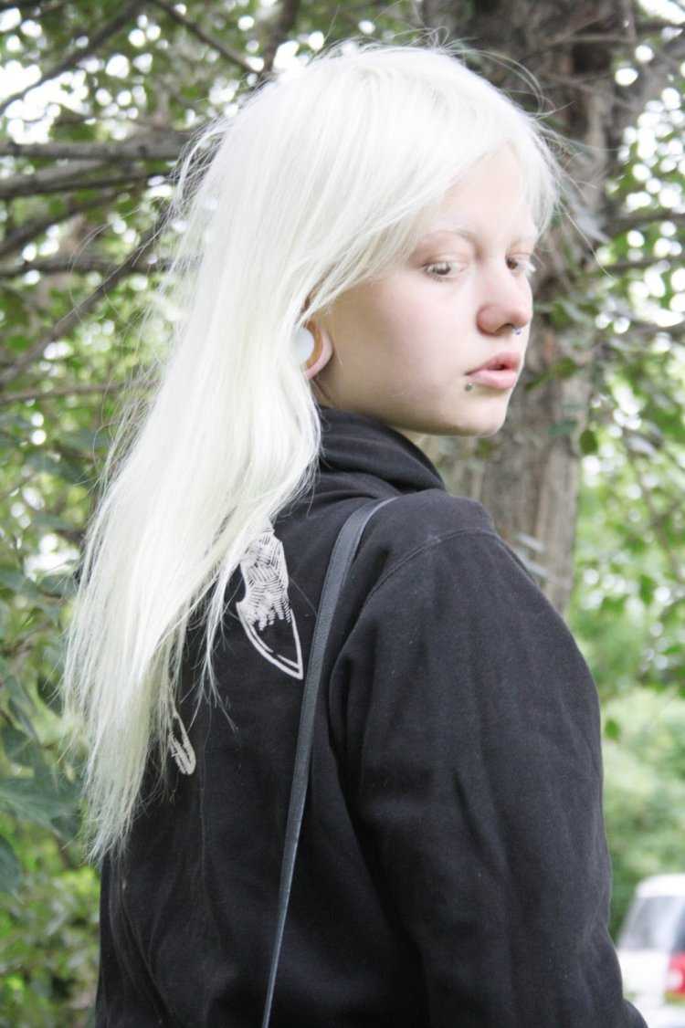 Терезе альбинос