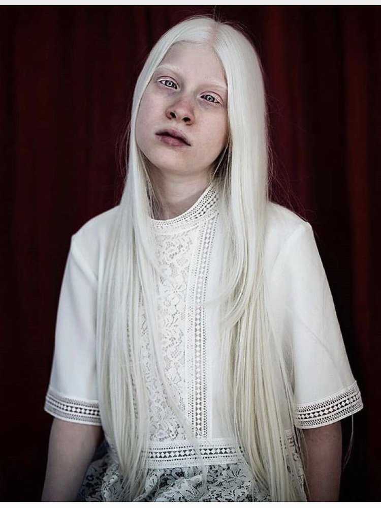 Человек альбинас Беляускас