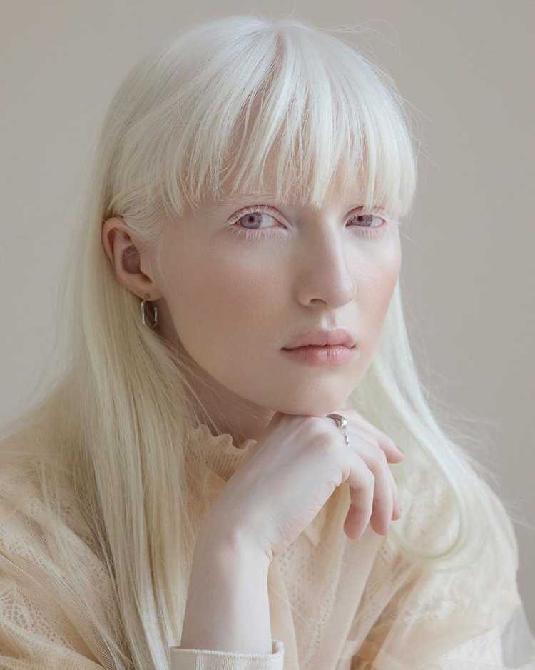 Катерина Тимошенко альбинос