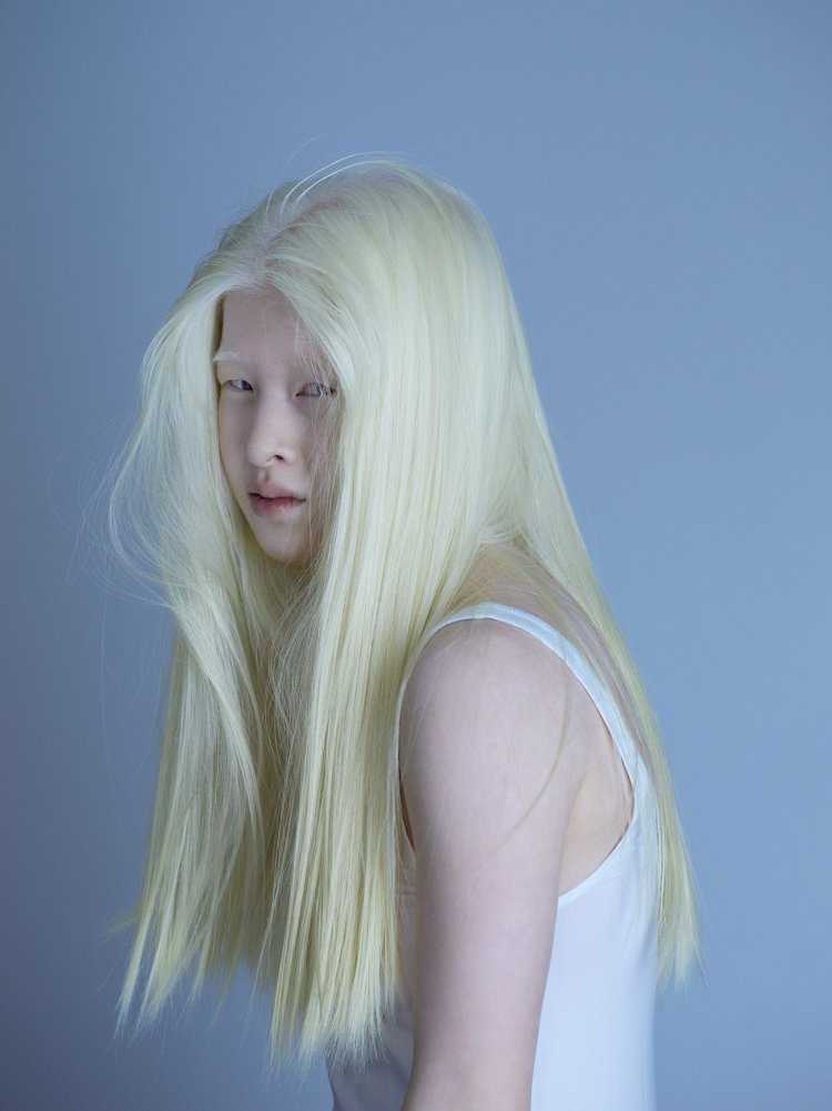 Альбинос китаянка Конни Чиу