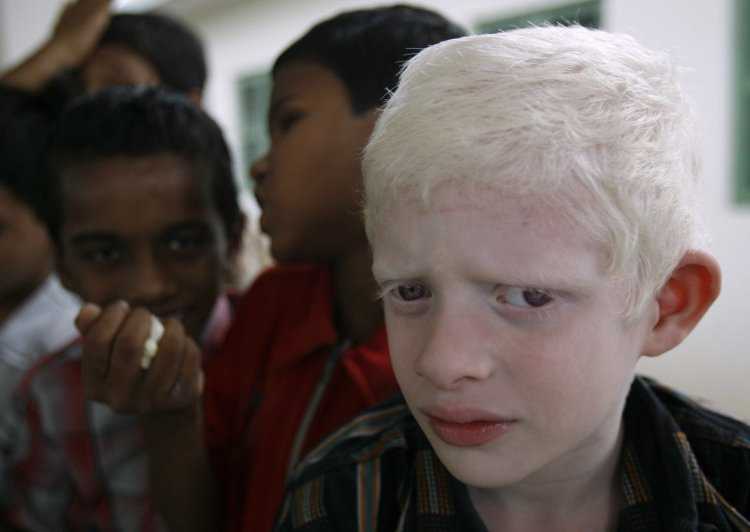 Дагестанец альбинос