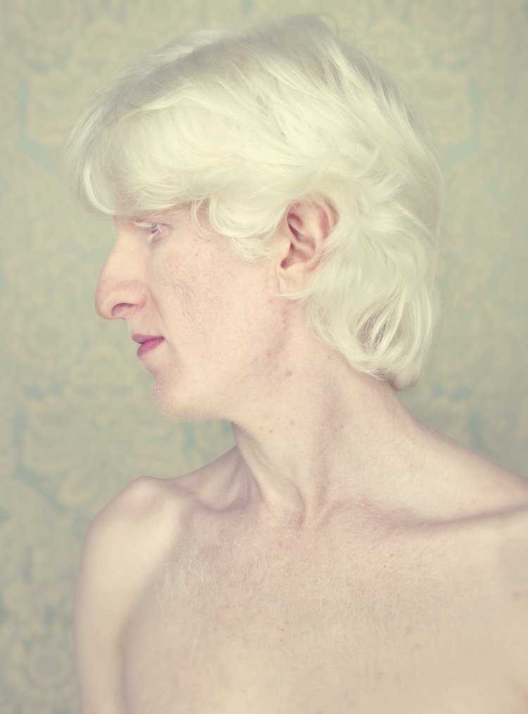 Саша Смирнов альбинос