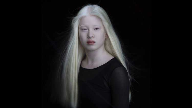 Катерина Тимошенко альбинос