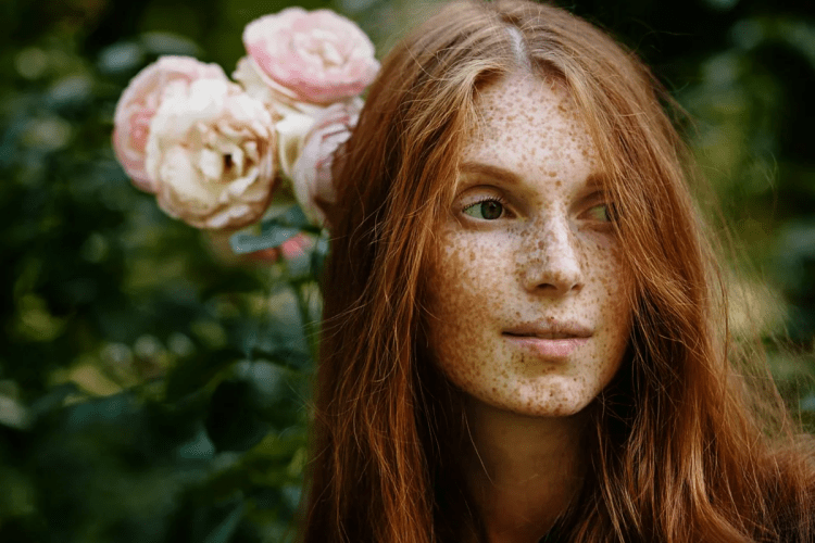 Долорес веснушки