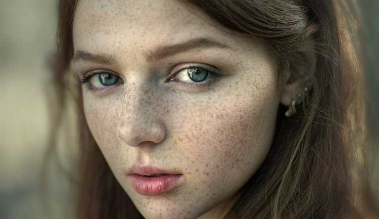 Юрий веснушки