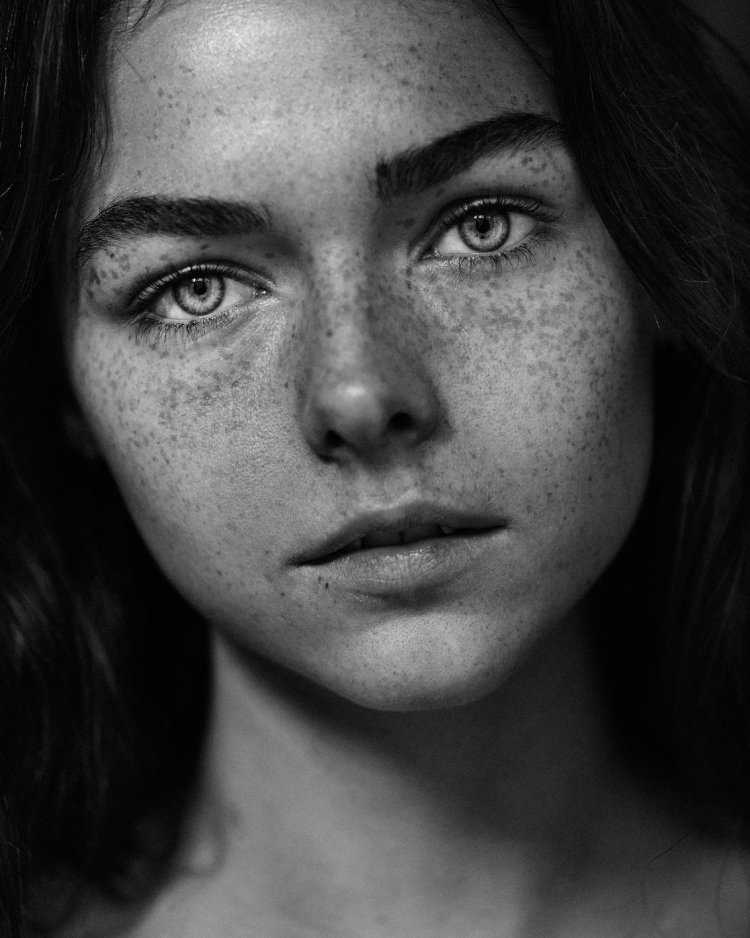 Питер Линдберг веснушки