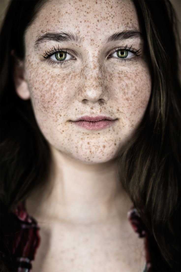 Freckles Оливия