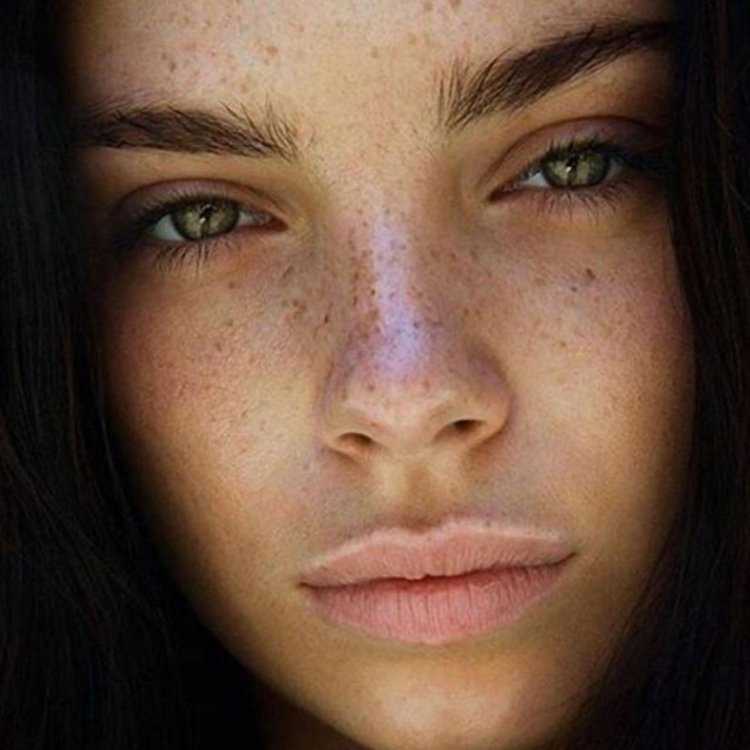 Веснушки популярные