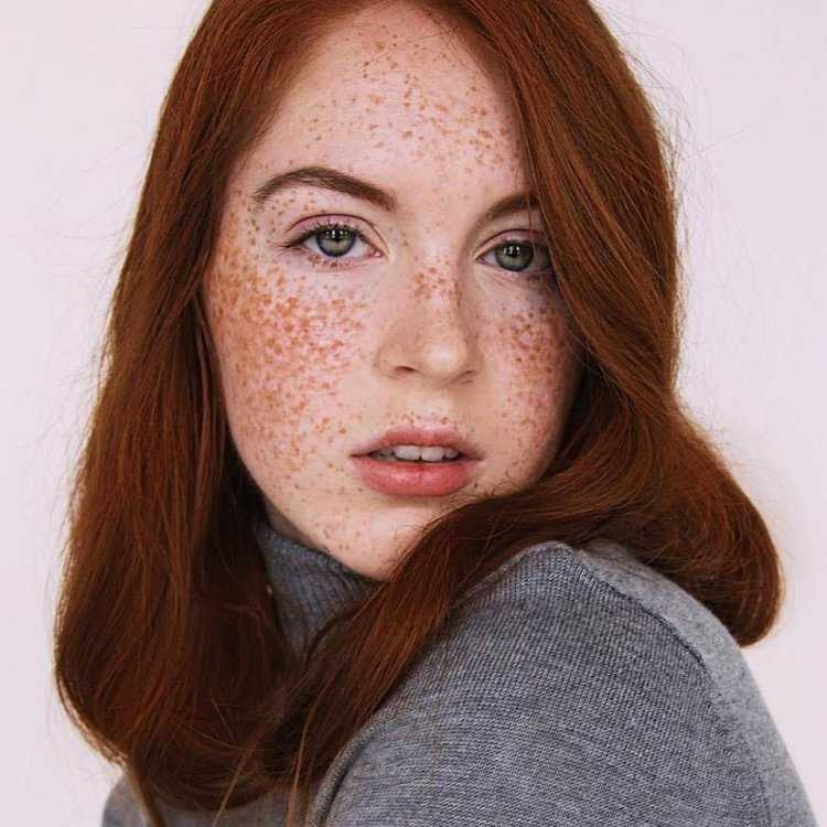 Freckles Эвелина Лашук