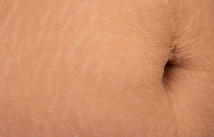 Женское анальное отверстие