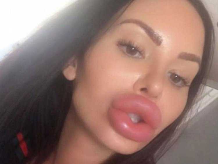 Женщины с надутыми губами