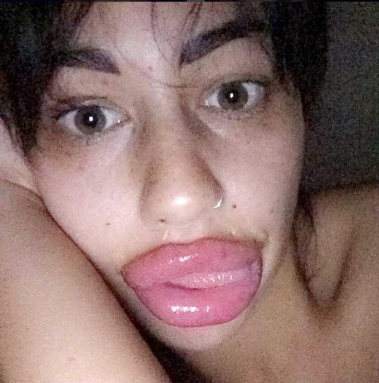 Самые большие накаченные губы