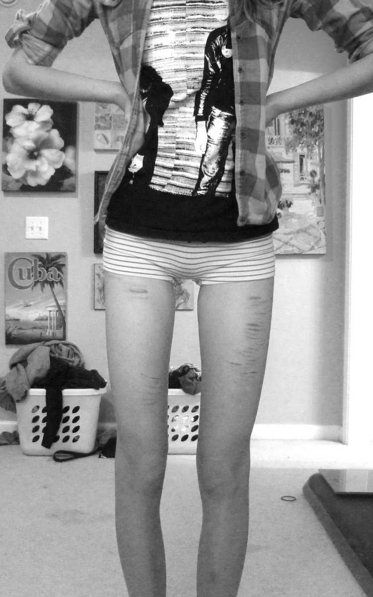 Thigh gap девушки