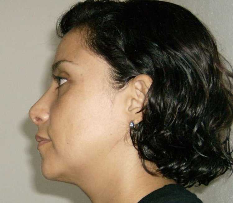 Орлиный нос с горбинкой