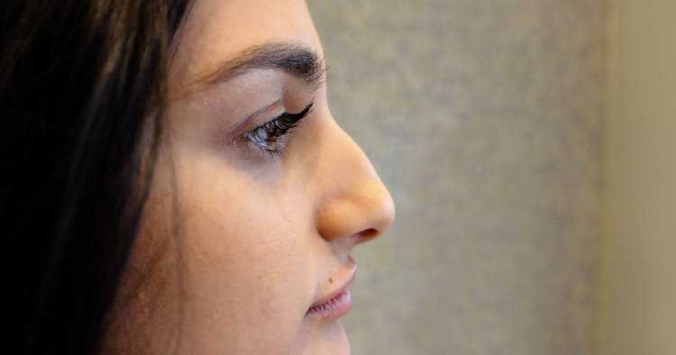 Нос с горбинкой у девушки