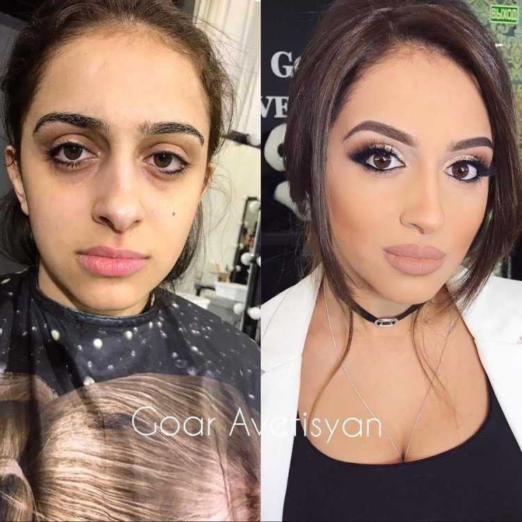Гоар Аветисян до и после