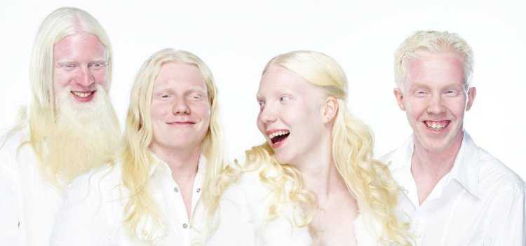 Пуллан альбиносы