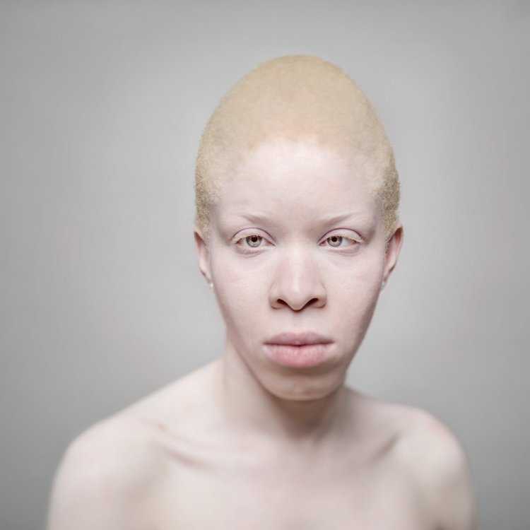 Афроазиат альбинос