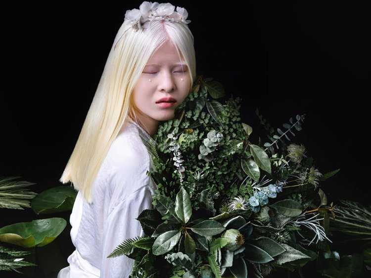 Диана Форест модель альбинос