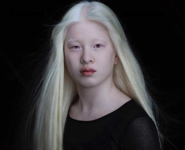 Китаянка альбинос15