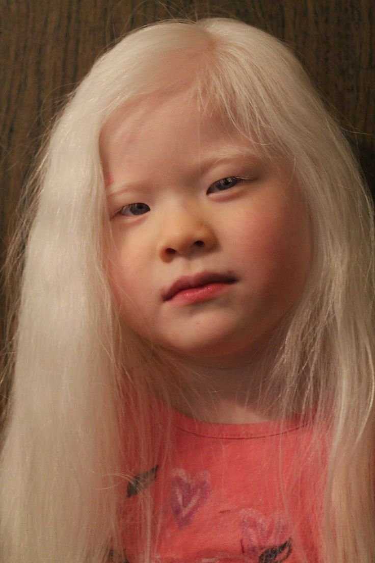 Корейцы альбиносы