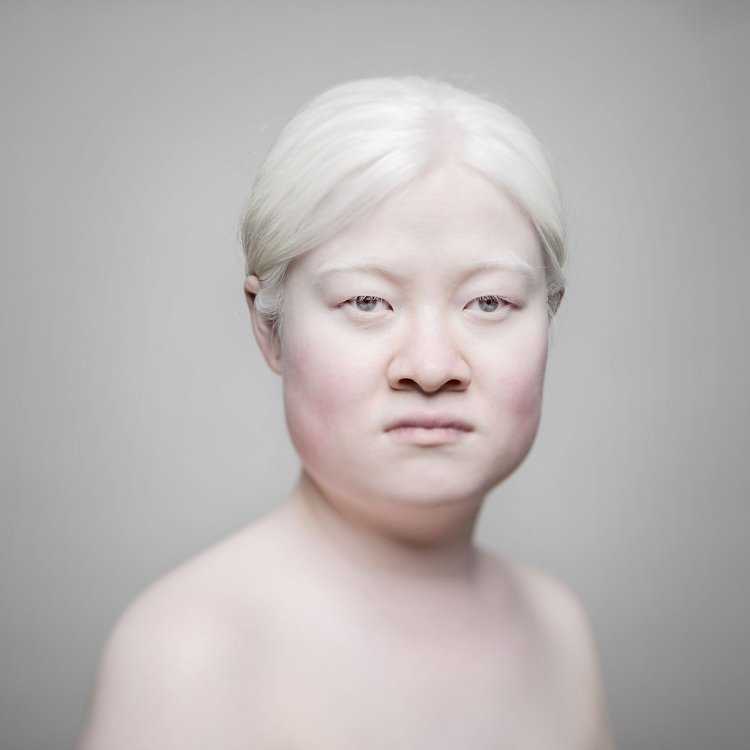 Монгол альбинос