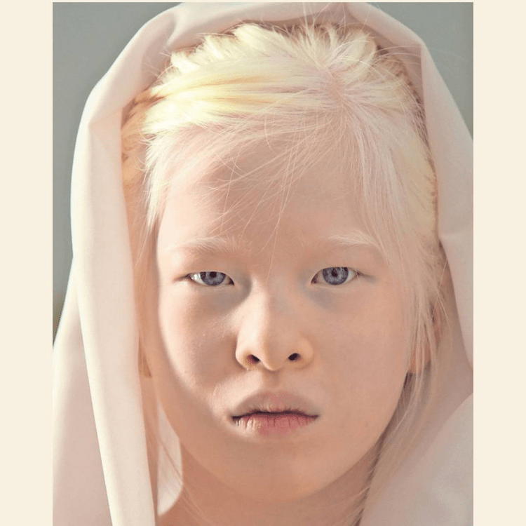 Корейцы альбиносы