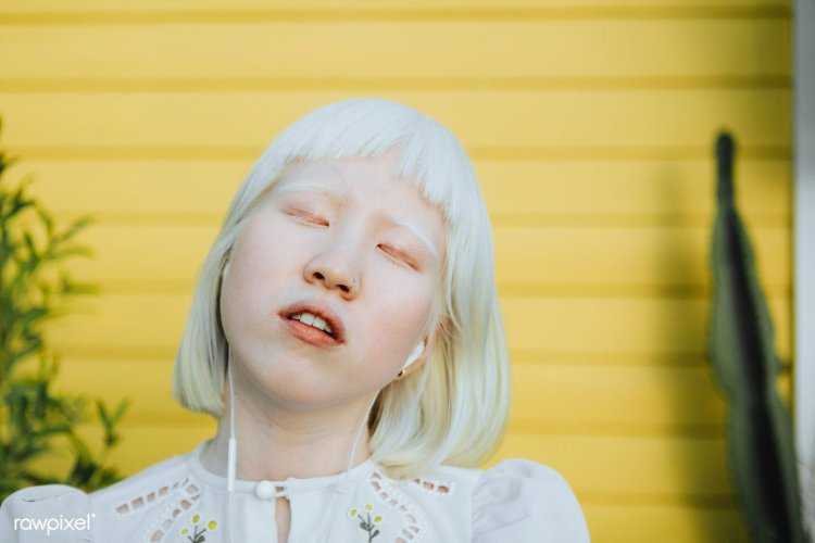 Айдол альбинос