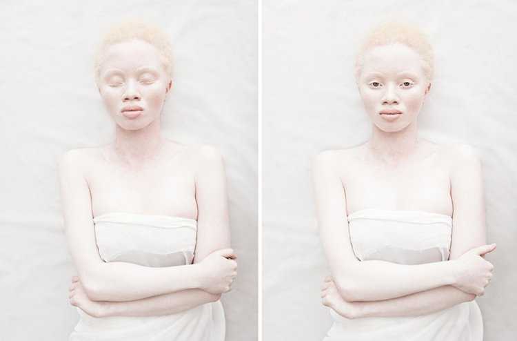 Джуэл Джеффри фотомодель альбинос