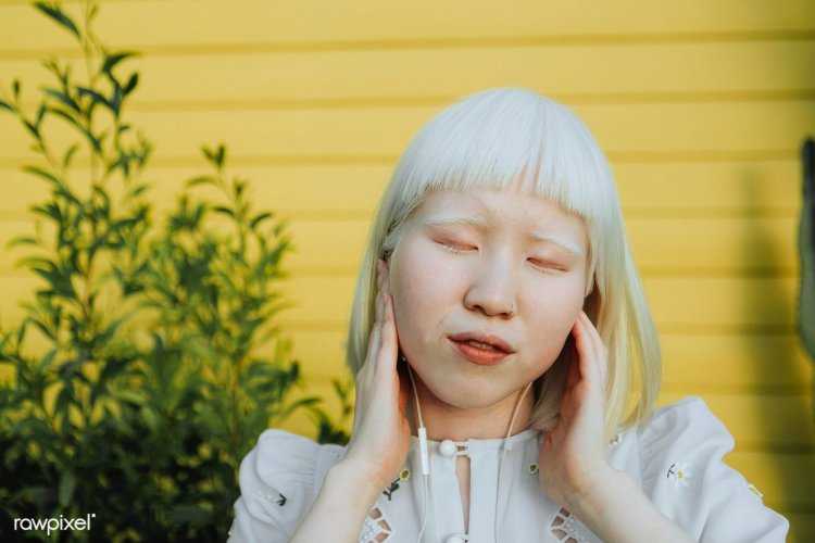 Корейцы альбиносы