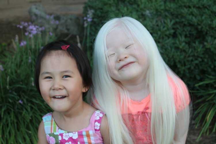 Asian Albino