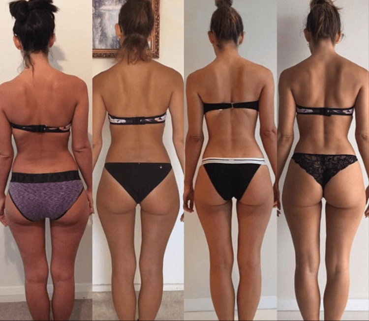 Идеальная форма ягодиц у женщин