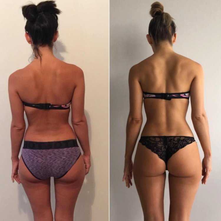 Формы ягодиц