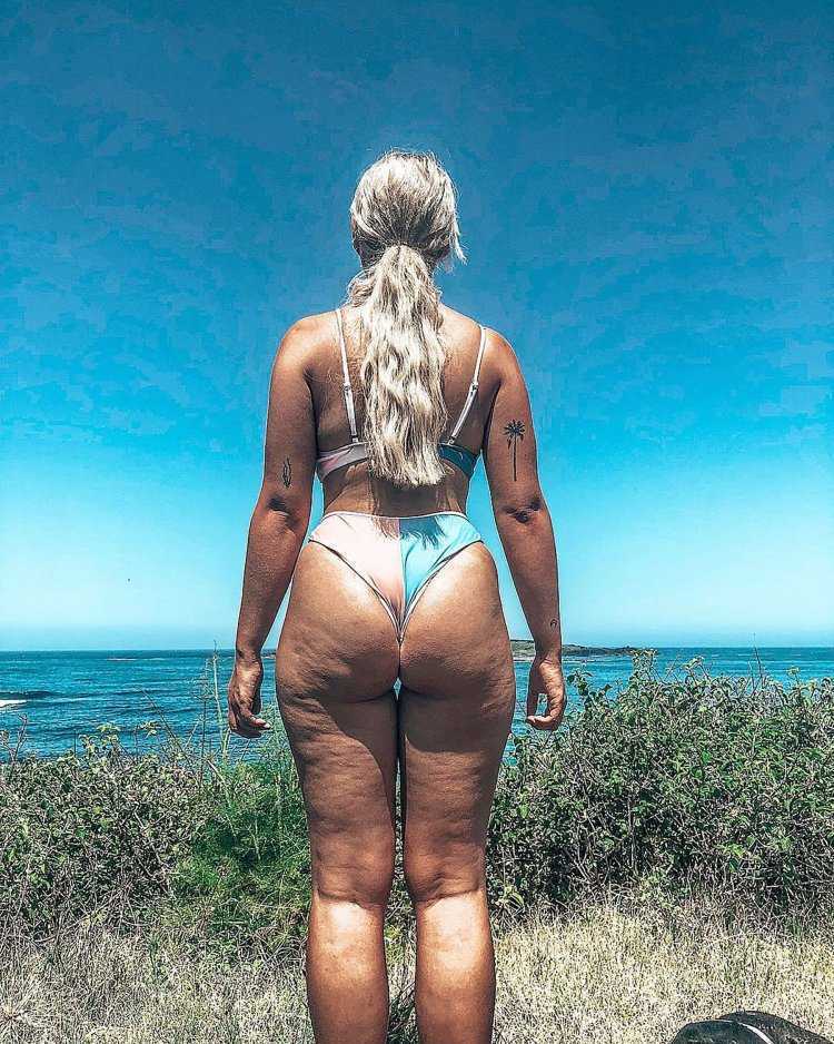 Красивые женщины с целлюлитом