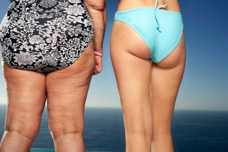 Барбара Феррейра целлюлит