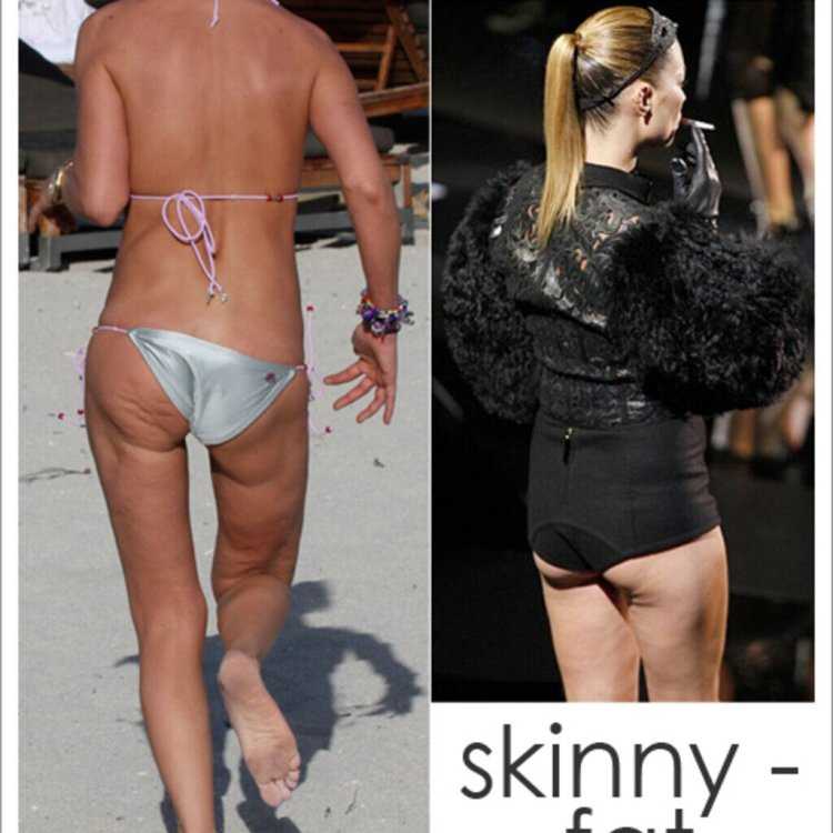 Совершенный тип фигуры: Skinny Fat