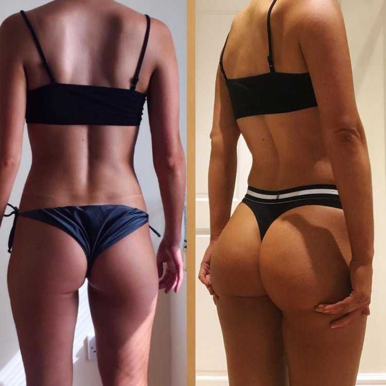 Асимметричные ягодицы