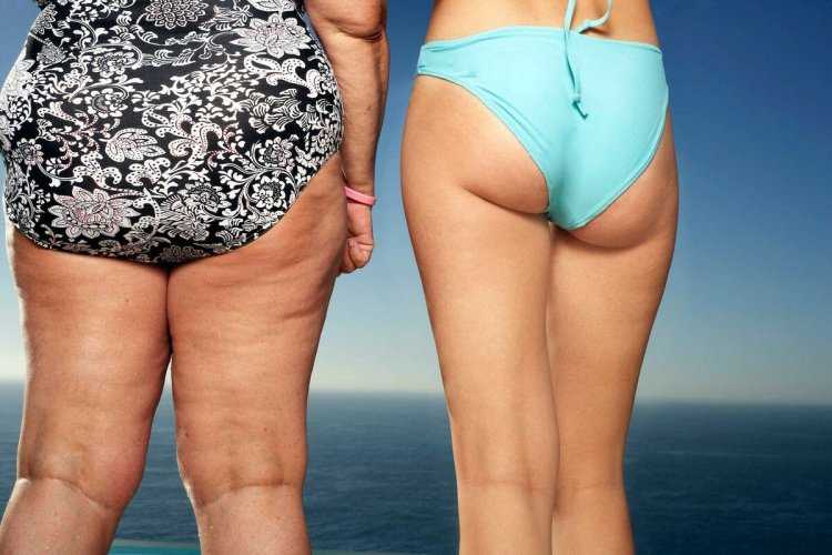 Барбара Феррейра целлюлит