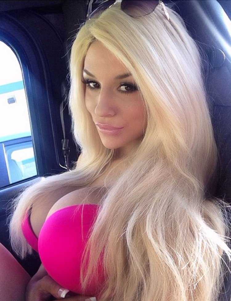 Увеличение ягодиц имплантами