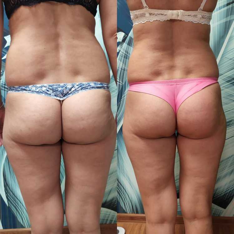 Пышка Эмбер Рейн задница