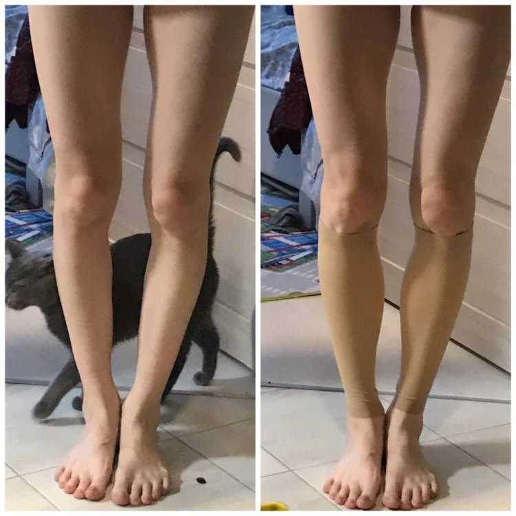 Изумительные худые колени, символ красоты и изящества