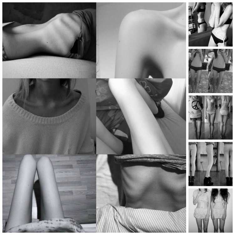 Карина Кравцова - идеальный образ анорексички, такой нежный и хрупкий