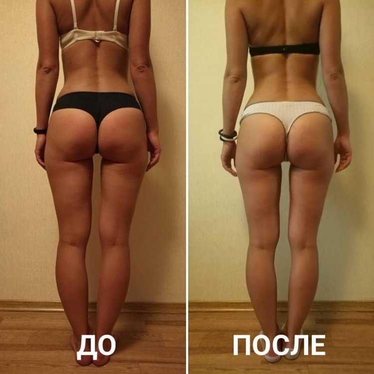 Накаченные ягодицы до и после