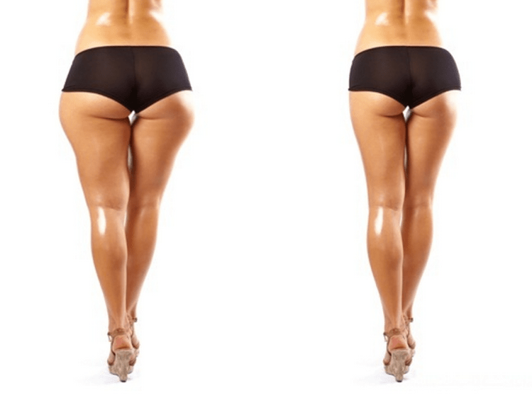 Фигура с галифе на бедрах