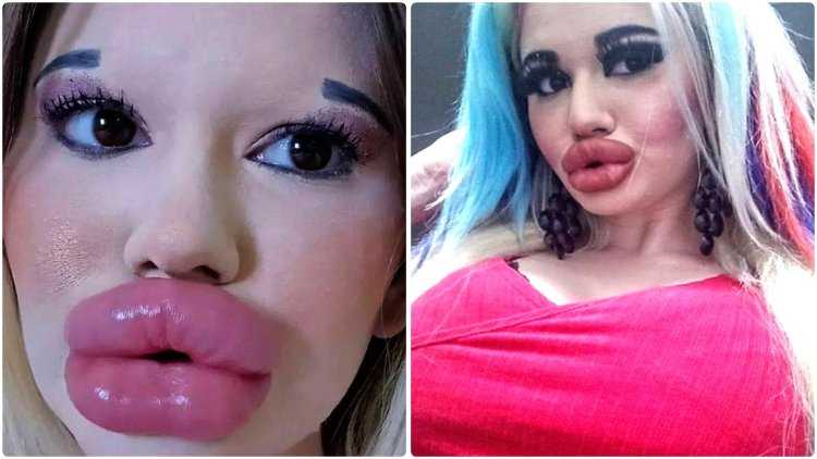 Губастая пышка1