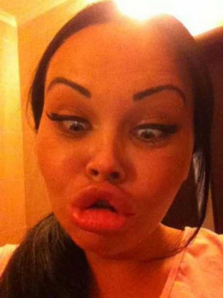 Утиные губки девушек