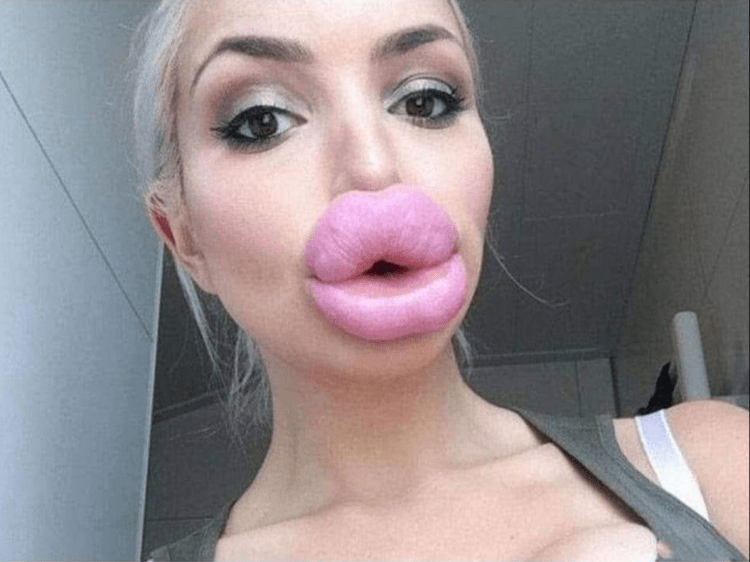 Огромные губы