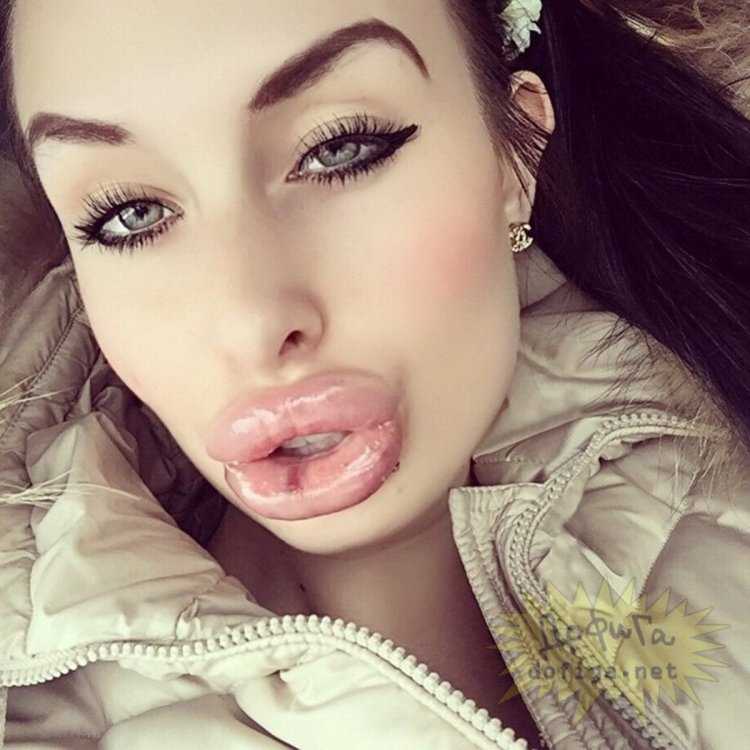 Губошлепка Кайли