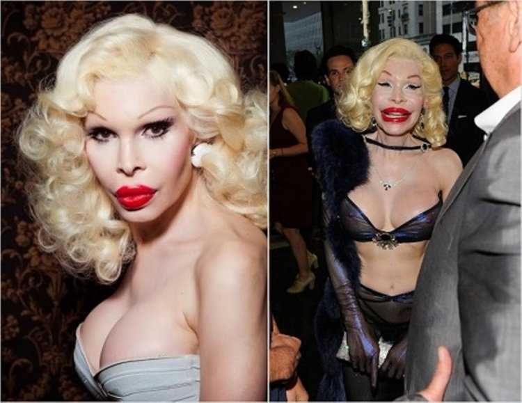 Аманда Лепор до операции