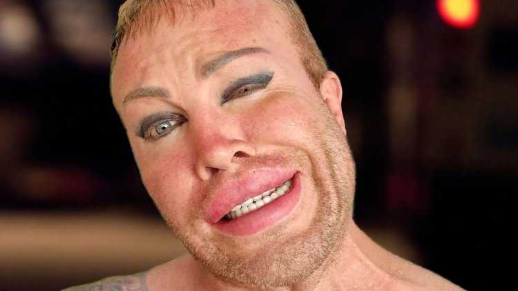 Губастые актеры россии35